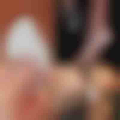 Fișă pentru picioare din sticlă | PEDIGLASS